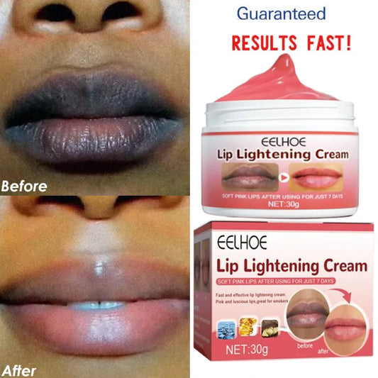 Rose Kiss – Le secret des lèvres naturellement rose